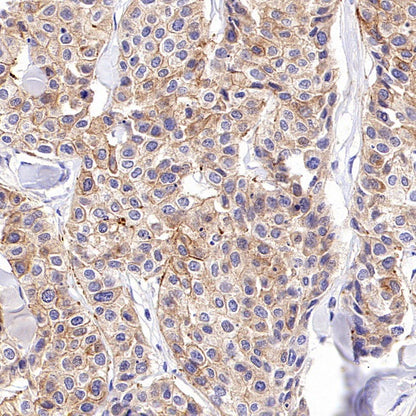 ZO-1 Recombinant Rabbit mAb (S-2188-12)