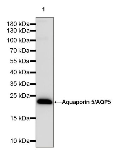 Aquaporin 5/AQP5 Recombinant Rabbit mAb (S-1622-5)