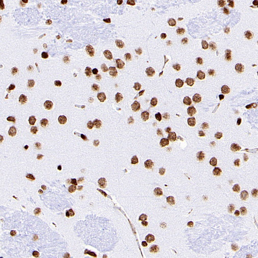 Histone H3 (acetyl K18) Recombinant Rabbit mAb (S-1688-90)