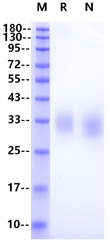 Fc γ RIIA/CD32a His Tag Protein, Rhesus macaque