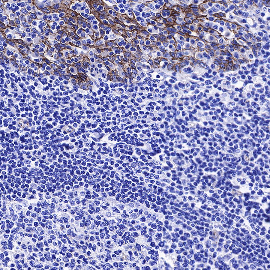 β-Catenin Recombinant Rabbit mAb,PBS Only (SDT-336-23)