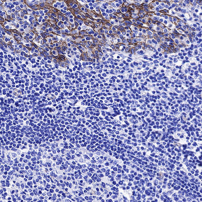 β-Catenin Recombinant Rabbit mAb,PBS Only (SDT-336-23)