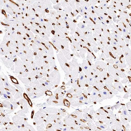 EHD2 Recombinant Rabbit mAb (S-1580-60)