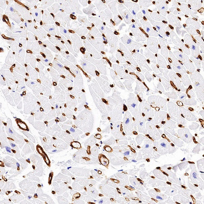 EHD2 Recombinant Rabbit mAb (S-1580-60)