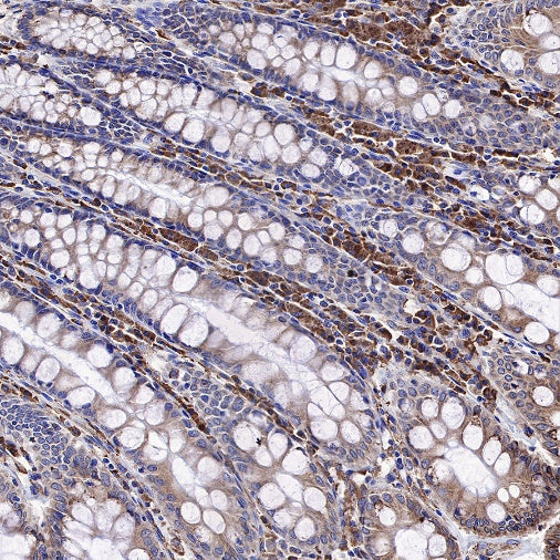 Calreticulin Recombinant Rabbit mAb (S-R353)