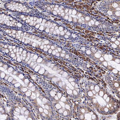 Calreticulin Recombinant Rabbit mAb (S-R353)