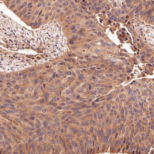 PI3 Kinase p85 Recombinant Rabbit mAb (SDT-R108)