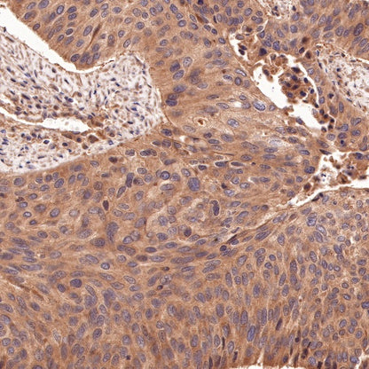 PI3 Kinase p85 Recombinant Rabbit mAb (SDT-R108)