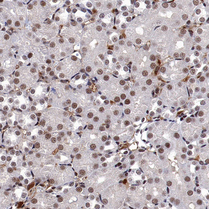 Keap1 Recombinant Rabbit mAb (S-1520-8)