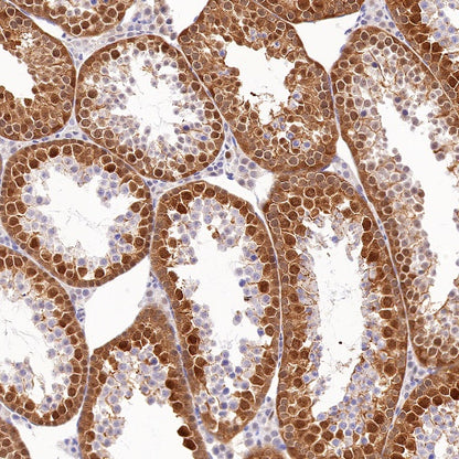 CDK2 Recombinant Rabbit mAb (S-1308-13)