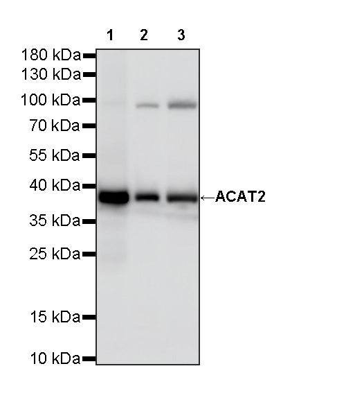 ACAT2 Recombinant Rabbit mAb