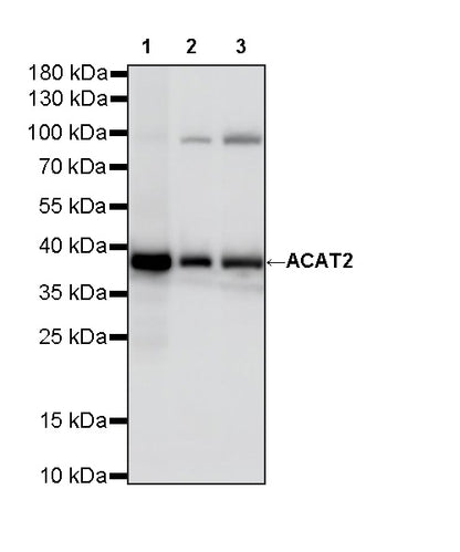 ACAT2 Recombinant Rabbit mAb