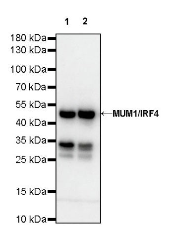 IRF4 Recombinant Rabbit mAb (S-654-33)