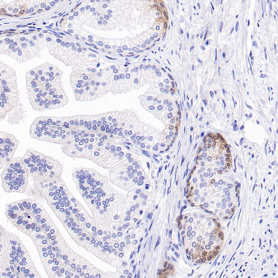 4E-BP1 Recombinant Rabbit mAb (S-1654-47)