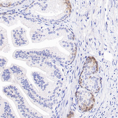 4E-BP1 Recombinant Rabbit mAb (S-1654-47)