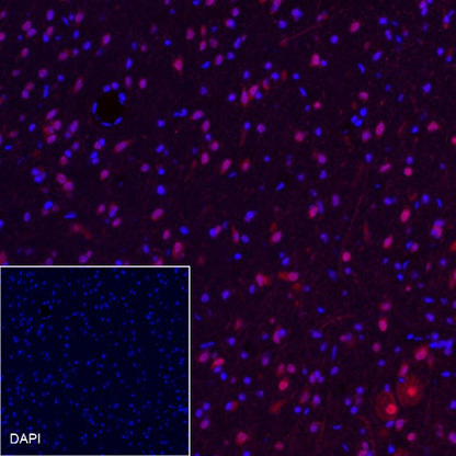 MSH6 Recombinant Rabbit mAb (Alexa Fluor® 555 Conjugate) (SDT-R094)