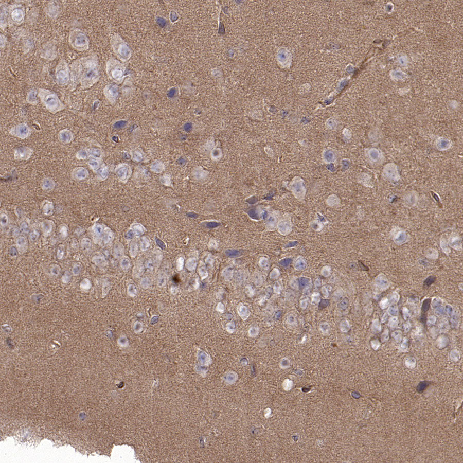BCAR1 Recombinant Rabbit mAb (S-3542-49)