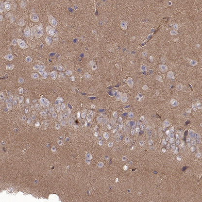 BCAR1 Recombinant Rabbit mAb (S-3542-49)