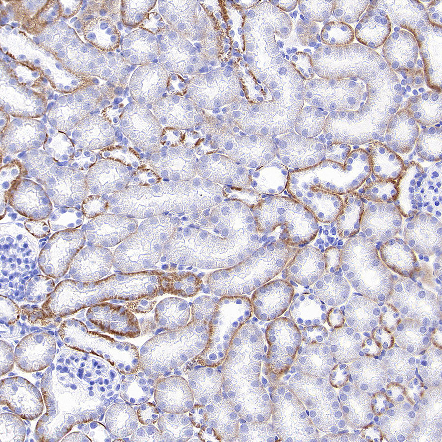 SLC5A1/SGLT1 Recombinant Rabbit mAb (S-4122-30)