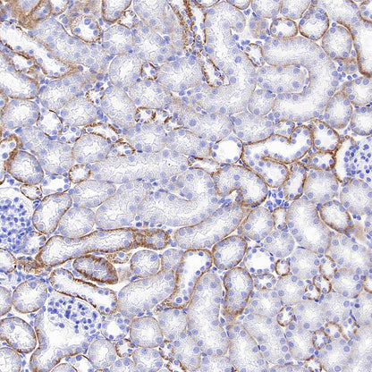 SLC5A1/SGLT1 Recombinant Rabbit mAb (S-4122-30)