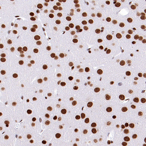 SUMO-1 Recombinant Rabbit mAb (S-625-111)