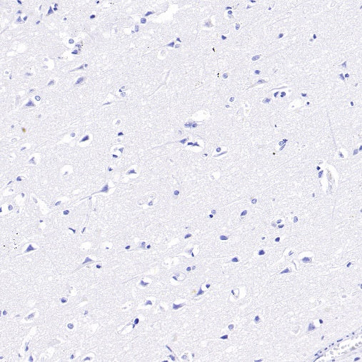 MAFA Recombinant Rabbit mAb (SDT-2040-6)