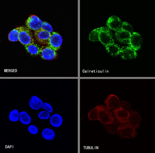 Calreticulin Recombinant Rabbit mAb (S-R353)