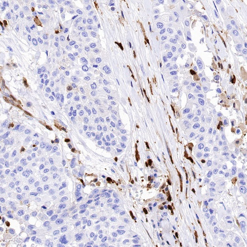 S100A4 Recombinant Rabbit mAb (S-1655-26)