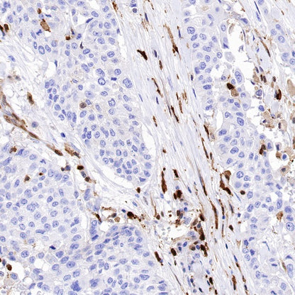 S100A4 Recombinant Rabbit mAb (S-1655-26)