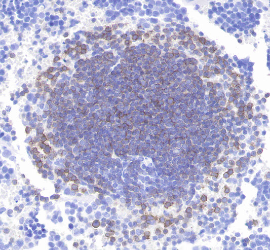 CD21 Recombinant Rabbit mAb,PBS Only (SDT-007-36)