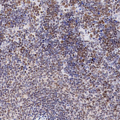 TBX18 Recombinant Rabbit mAb (S-4619-17)