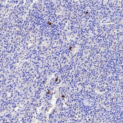 Human IgA1 Rabbit Polyclonal Antibody