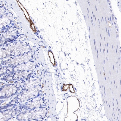 eNOS Recombinant Rabbit mAb (S-1885-94)