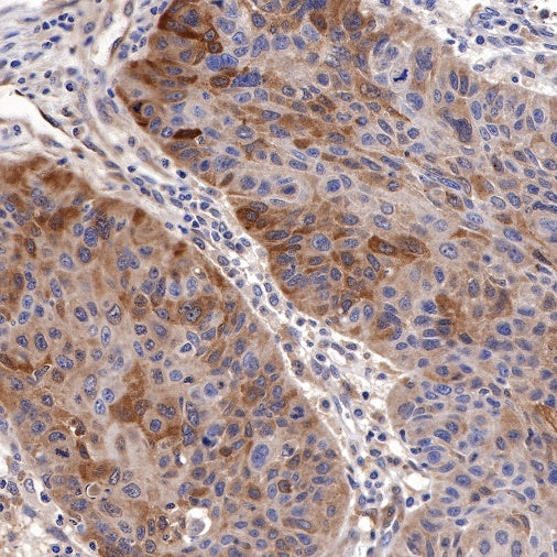 LC3B Recombinant Rabbit mAb (S-477-89)