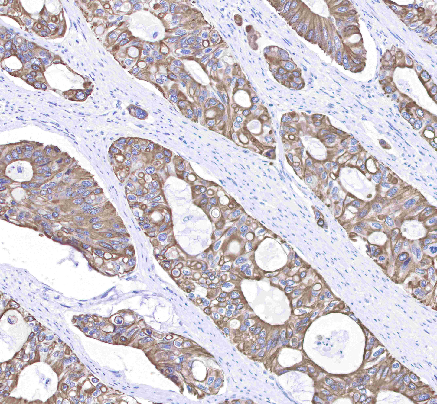Keratin 8 Recombinant Rabbit mAb,PBS Only (SDT-016-46)