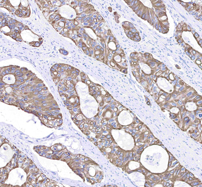Keratin 8 Recombinant Rabbit mAb,PBS Only (SDT-016-46)