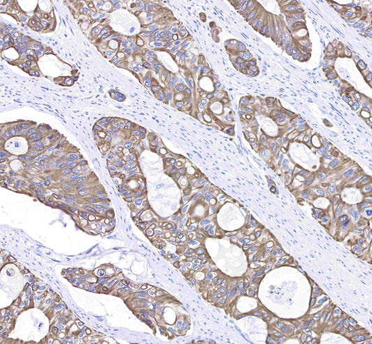 Keratin 8 Recombinant Rabbit mAb,PBS Only (SDT-016-46)