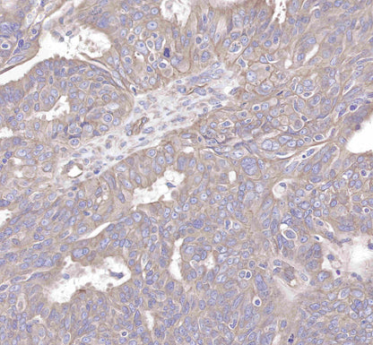 c-Met Rabbit mAb(SDT-009-7-2)