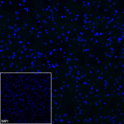 Lipocalin-2/NGAL Recombinant Rabbit mAb (S-2280-129)