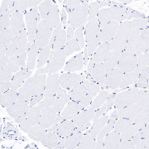 Amyloid Precursor Protein Recombinant Rabbit mAb (S-806-13)