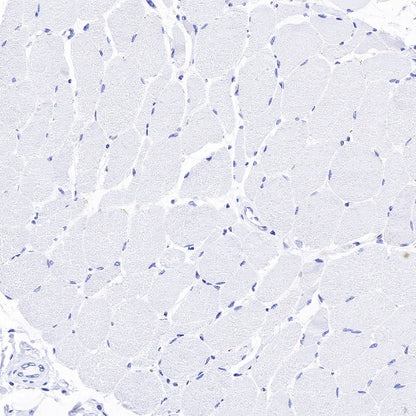Amyloid Precursor Protein Recombinant Rabbit mAb (S-806-13)