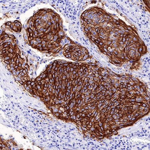 LYPD3/C4.4A Recombinant Rabbit mAb (S-R222)