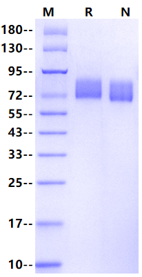ALCAM/CD166 His Tag Protein, Human