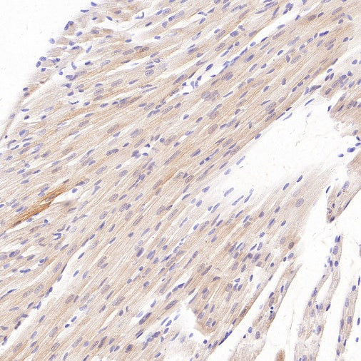 MYH7 Recombinant Rabbit mAb ,PBS Only (SDT-2936-44)