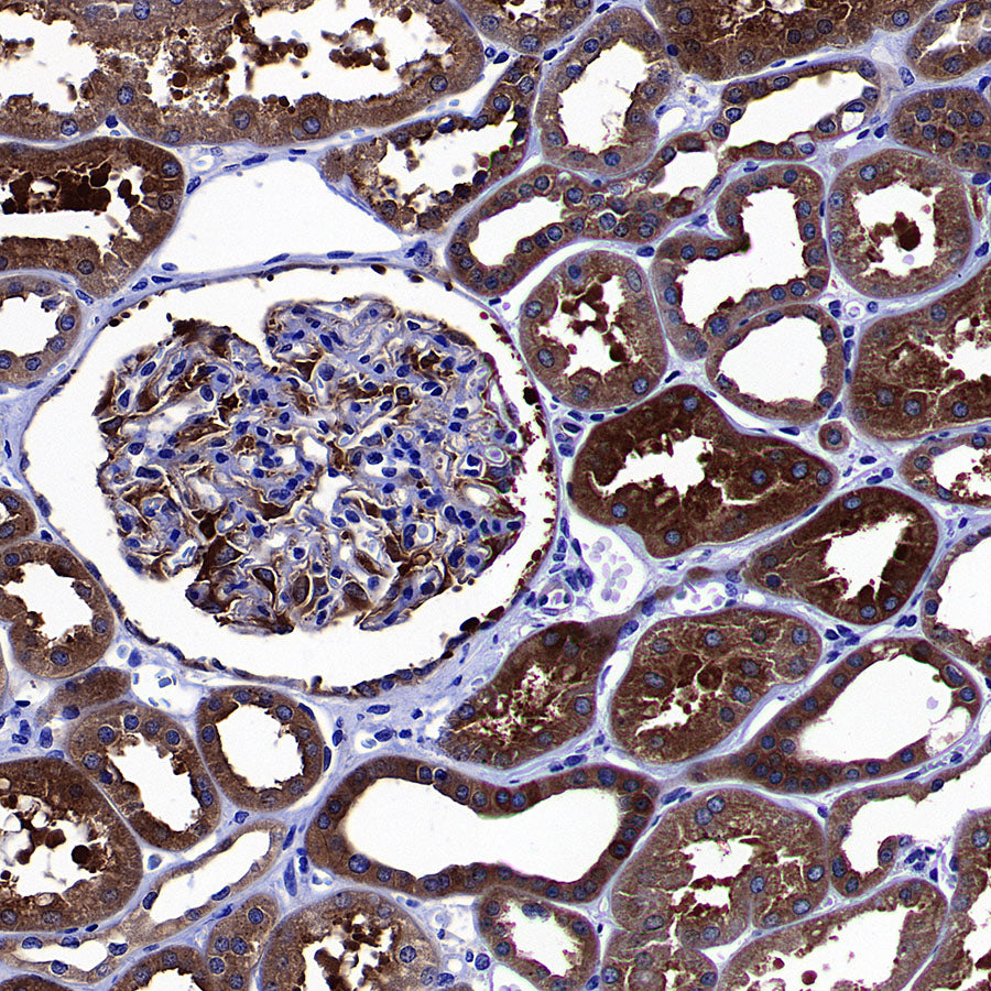 GFPT1 Recombinant Rabbit mAb (S-4752-19)