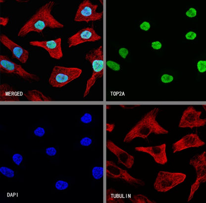 TOP2A Recombinant Rabbit mAb (S-513-107)