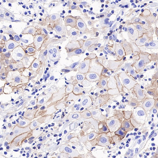 S-RMab® Nectin-4 Recombinant Rabbit mAb (SDT-277-314)