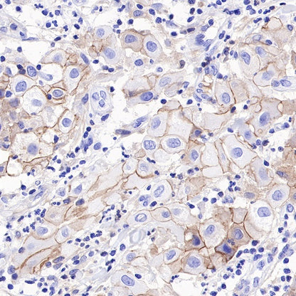 S-RMab® Nectin-4 Recombinant Rabbit mAb (SDT-277-314)