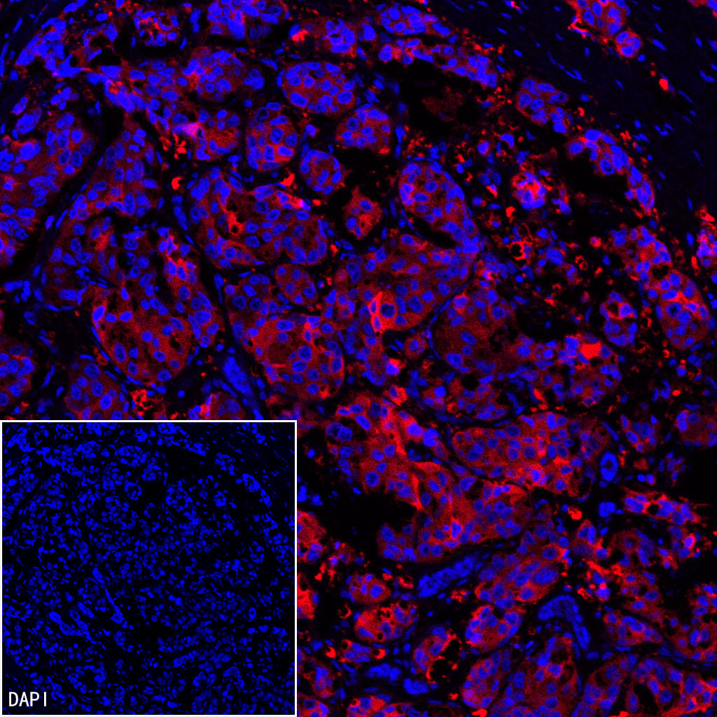 FASN Recombinant Rabbit mAb (Alexa Fluor® 555 Conjugate) (S-682-32)