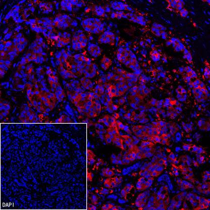 FASN Recombinant Rabbit mAb (Alexa Fluor® 555 Conjugate) (S-682-32)